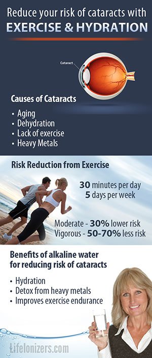 Reduce your risk of Cataracts with Exercising and Hydration